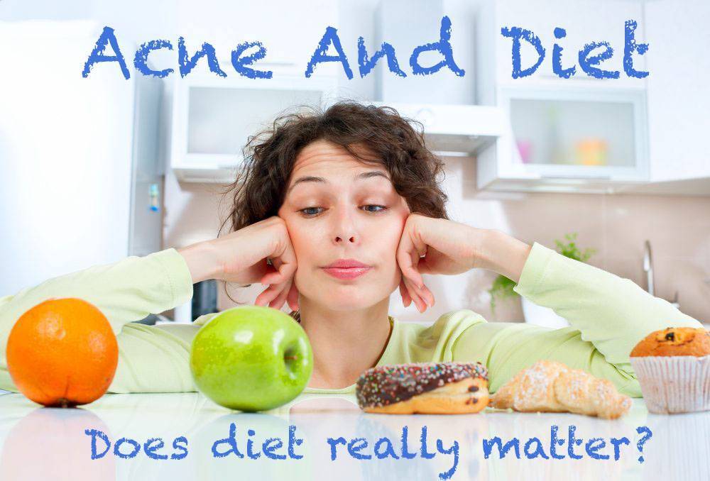 acne and diet